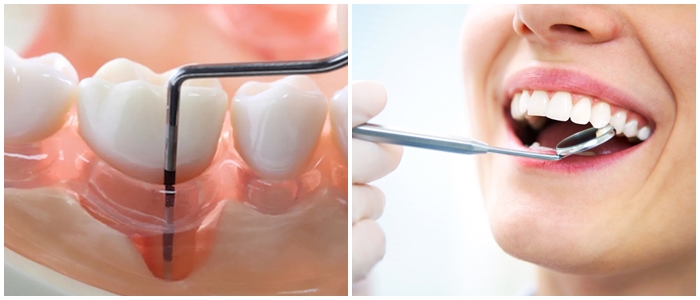 Lokal antibiyotik tedavisi