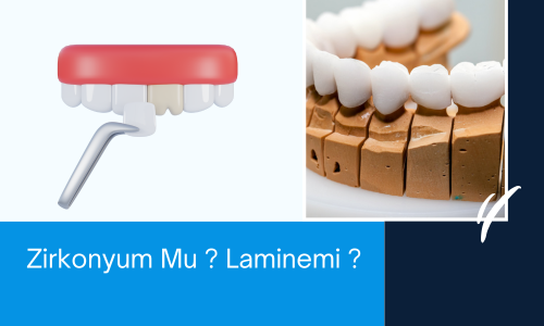 zirkonyum mu lamine mi